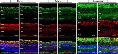 SIRT4 Is Highly Expressed in Retinal Müller Glial Cells